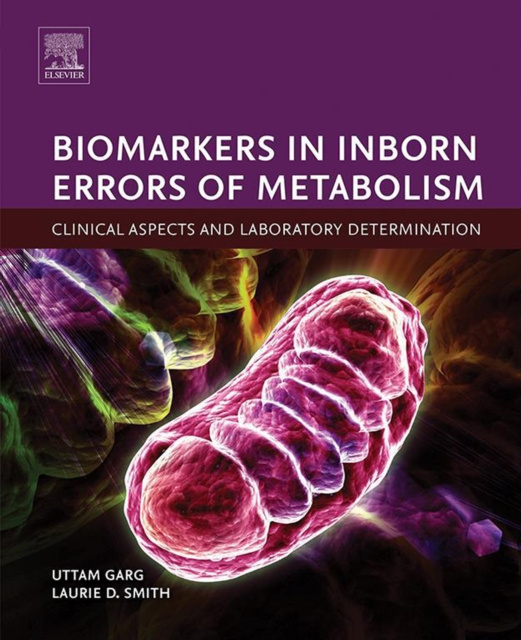 E-kniha Biomarkers in Inborn Errors of Metabolism Uttam Garg