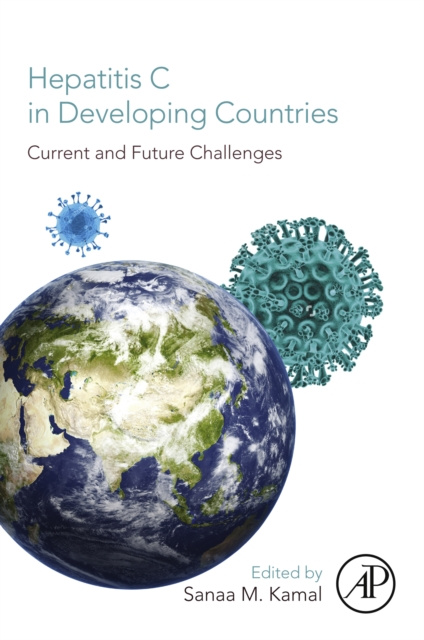E-kniha Hepatitis C in Developing Countries Sanaa M. Kamal