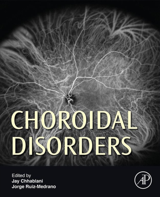 E-knjiga Choroidal Disorders Jay Chhablani