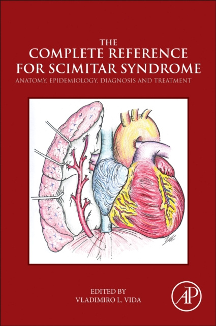 E-book Complete Reference for Scimitar Syndrome Vladimiro Vida