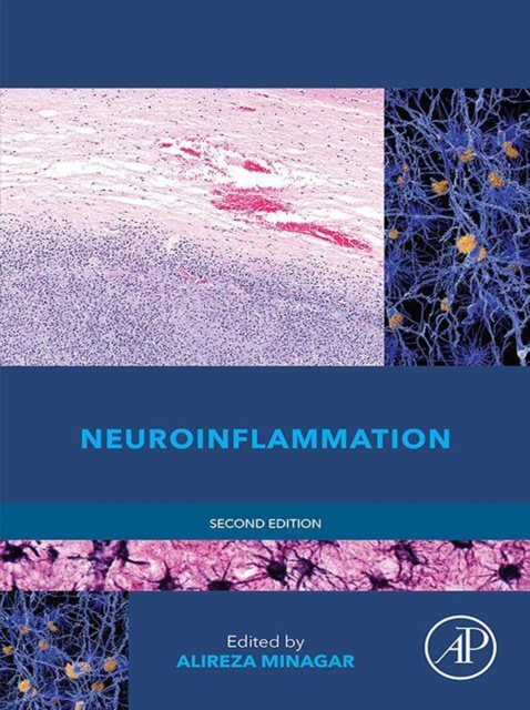 E-book Neuroinflammation Alireza Minagar