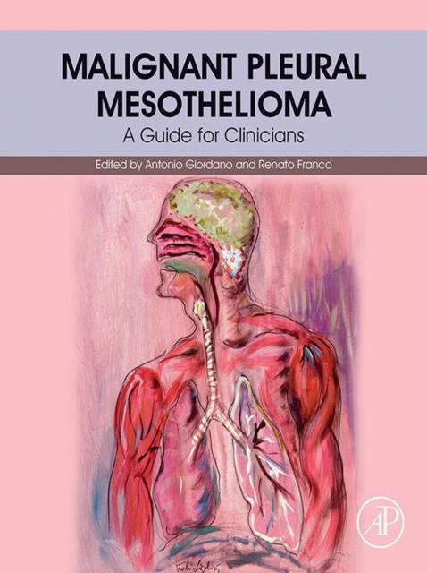 E-book Malignant Pleural Mesothelioma Antonio Giordano