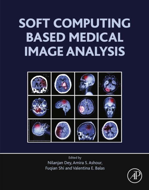 E-Book Soft Computing Based Medical Image Analysis Nilanjan Dey
