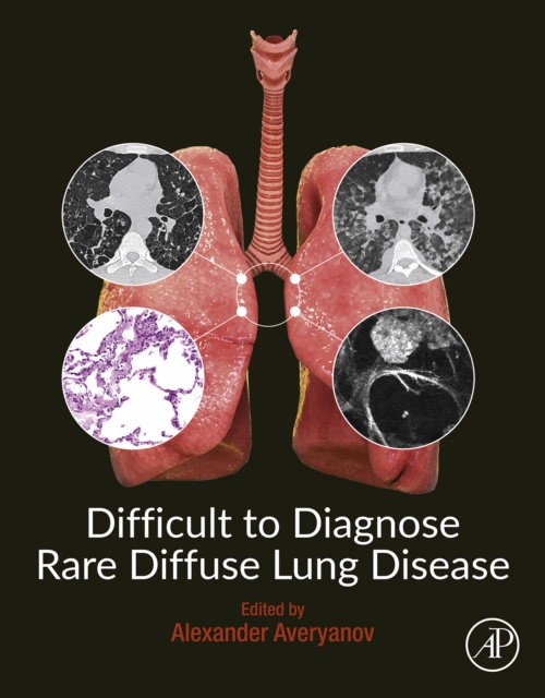 E-könyv Difficult to Diagnose Rare Diffuse Lung Disease Alexander V. Averyanov