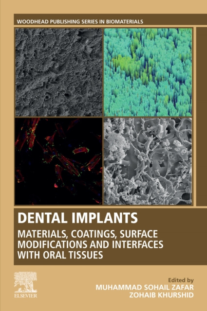 E-knjiga Dental Implants Muhammad Sohail Zafar