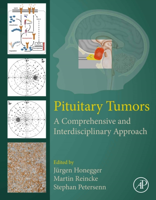 E-kniha Pituitary Tumors Jurgen Honegger