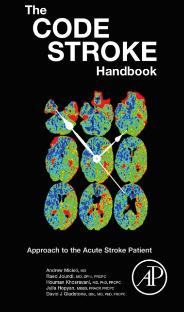E-knjiga Code Stroke Handbook Andrew Micieli