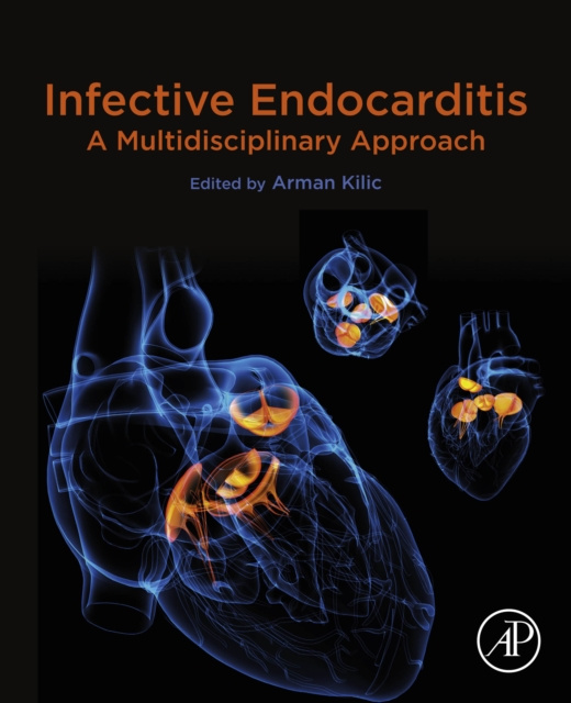 E-knjiga Infective Endocarditis Arman Kilic