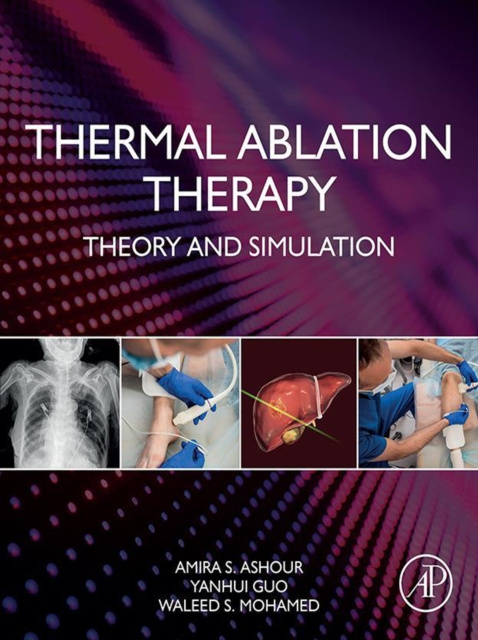 E-book Thermal Ablation Therapy Amira S. Ashour