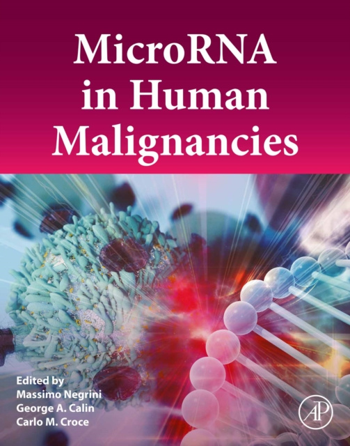 E-kniha MicroRNA in Human Malignancies Massimo Negrini