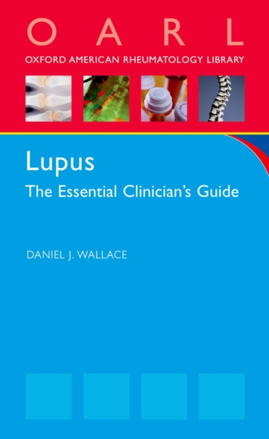 E-knjiga Lupus Daniel J Wallace