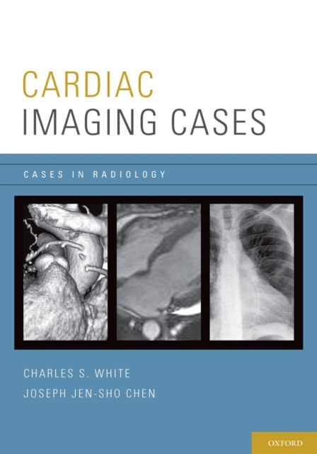 E-knjiga Cardiac Imaging Cases Charles White