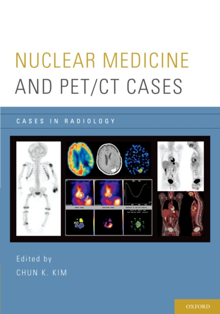 E-kniha Nuclear Medicine and PET/CT Cases Chun K. Kim