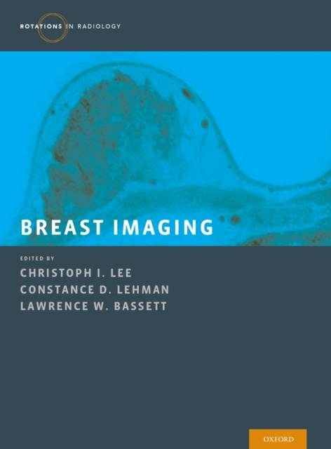 E-knjiga Breast Imaging Christoph I. Lee