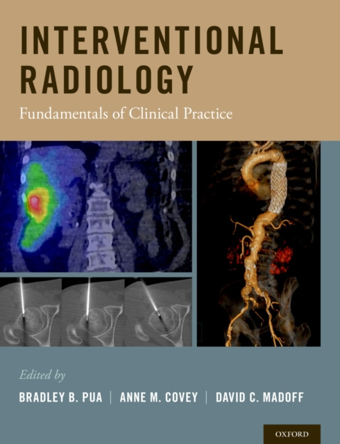 ebook Interventional Radiology Bradley B. Pua