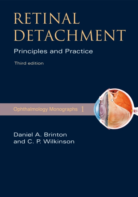 E-kniha Retinal Detachment Daniel A. Brinton M.D.