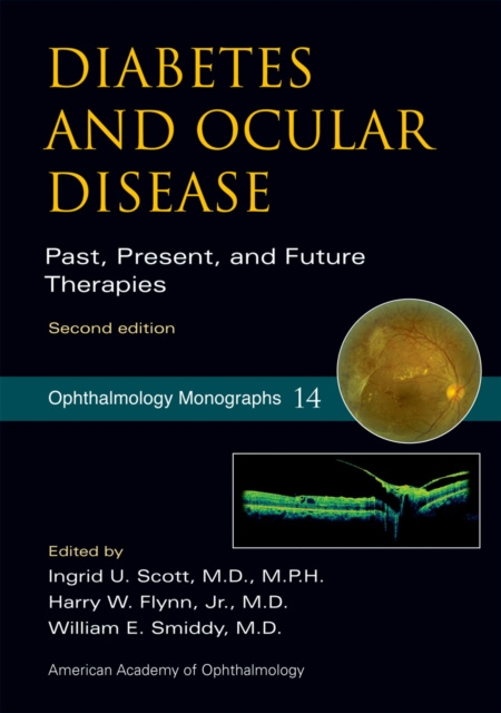 E-kniha Diabetes and Ocular Disease Ingrid Scott