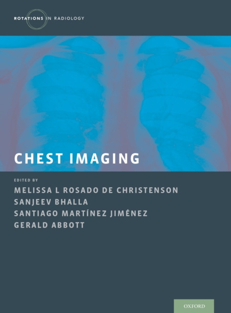 E-book Chest Imaging Melissa Rosado de Christensen