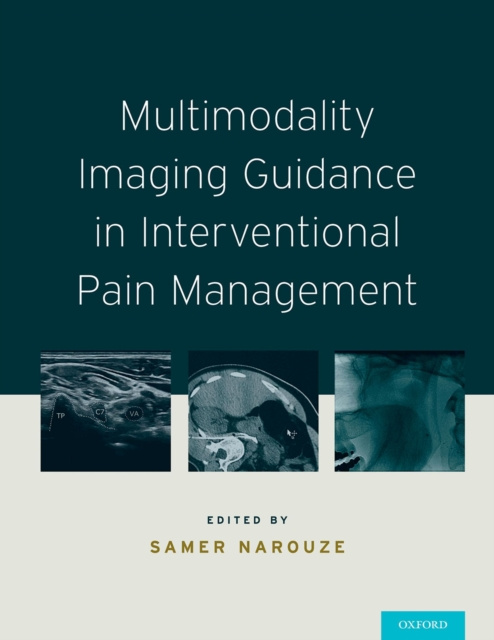 E-kniha Multimodality Imaging Guidance in Interventional Pain Management Samer N. Narouze