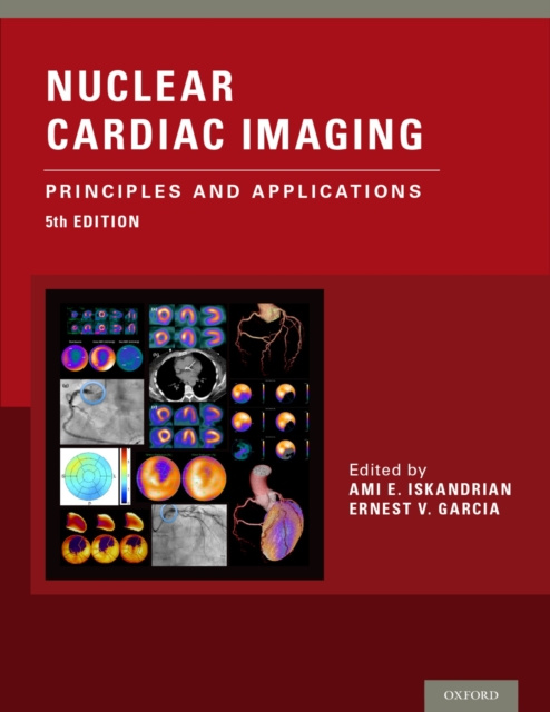E-kniha Nuclear Cardiac Imaging Ami E. Iskandrian