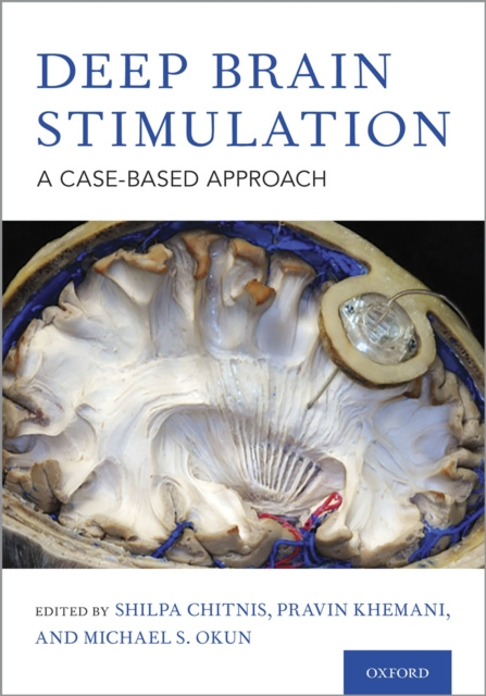 E-knjiga Deep Brain Stimulation PhD Shilpa Chitnis MD