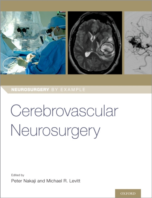 E-kniha Cerebrovascular Neurosurgery Dr Peter Nakaji