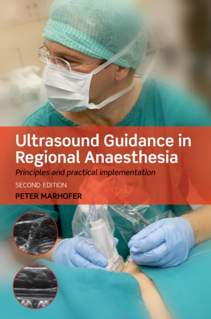 E-könyv Ultrasound Guidance in Regional Anaesthesia Peter Marhofer