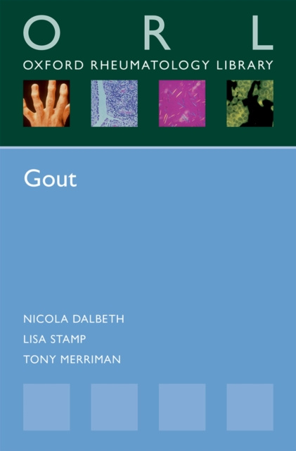 E-knjiga Gout Nicola Dalbeth