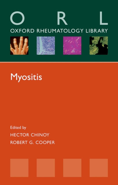E-book Myositis Hector Chinoy