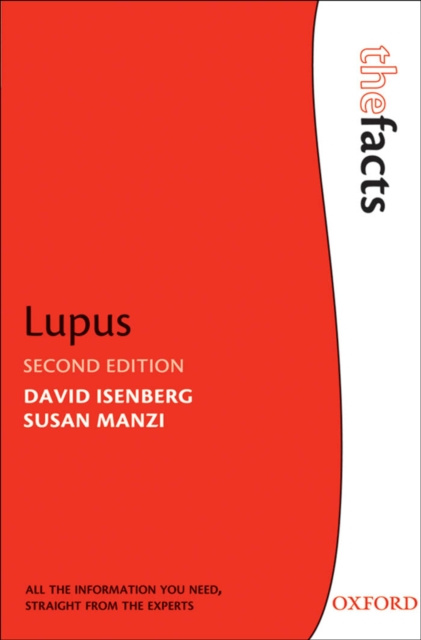 E-book Lupus David Isenberg