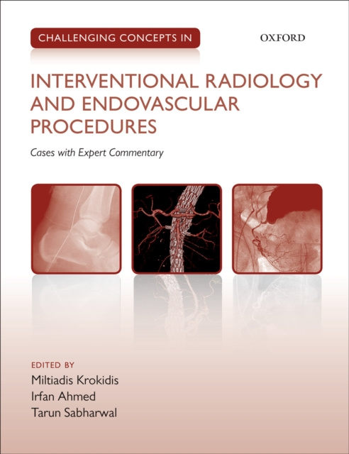 E-kniha Challenging Concepts in Interventional Radiology Miltiadis Krokidis