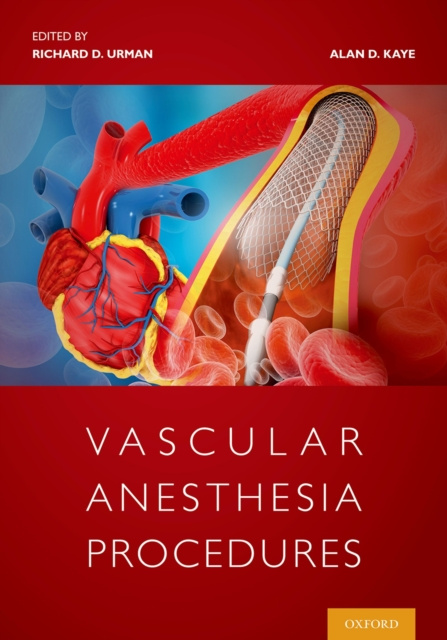 E-book Vascular Anesthesia Procedures Richard Urman