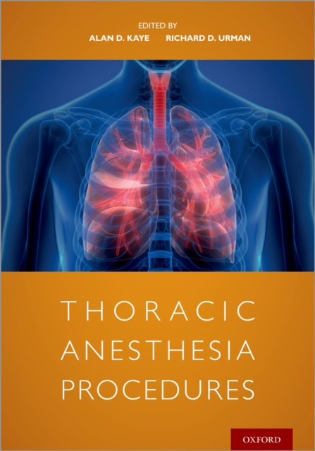 E-book Thoracic Anesthesia Procedures Alan Kaye
