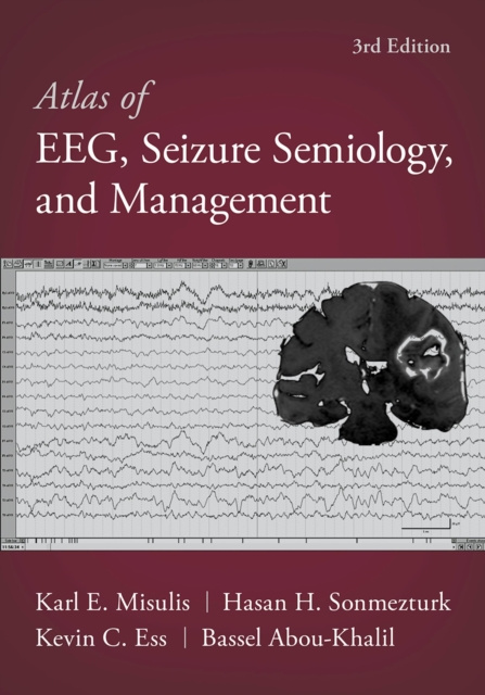 E-kniha Atlas of EEG, Seizure Semiology, and Management Bassel Abou-Khalil