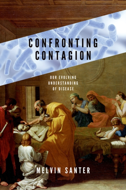 E-knjiga Confronting Contagion Melvin Santer