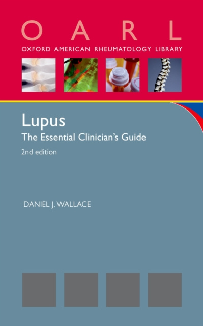 E-book Lupus Daniel J. Wallace