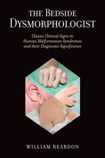 E-knjiga Bedside Dysmorphologist William Reardon