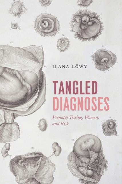 E-knjiga Tangled Diagnoses Lowy Ilana Lowy