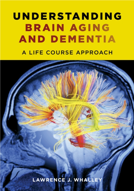 E-book Understanding Brain Aging and Dementia Lawrence J. Whalley