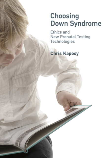 E-knjiga Choosing Down Syndrome Chris Kaposy