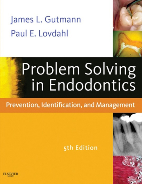 E-Book Problem Solving in Endodontics James L. Gutmann