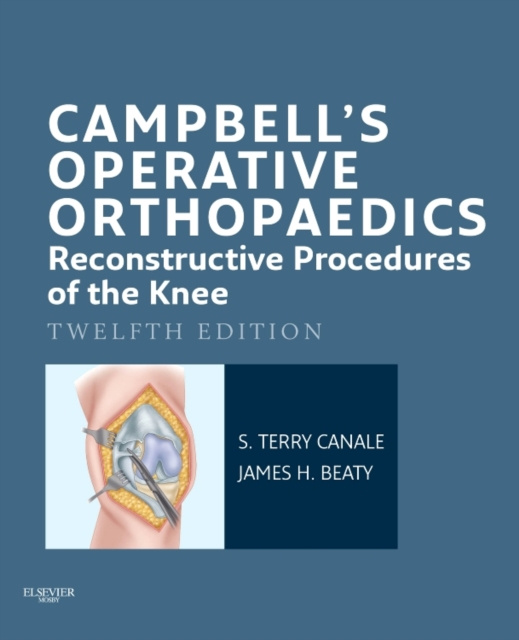 E-kniha Campbell's Operative Orthopaedics: Reconstructive Procedures of the Knee E-Book S. Terry Canale