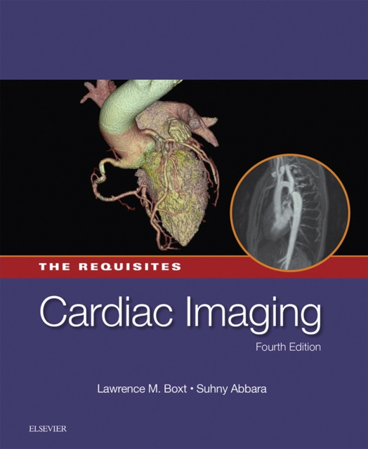 E-kniha Cardiac Imaging: The Requisites E-Book Lawrence Boxt