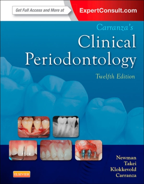 E-kniha Carranza's Clinical Periodontology - E-Book Michael G. Newman