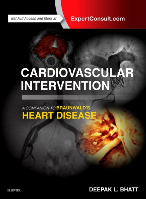 E-kniha Cardiovascular Intervention: A Companion to Braunwald's Heart Disease E-Book Deepak L. Bhatt
