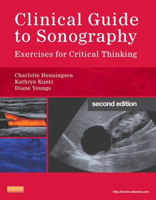 E-kniha Clinical Guide to Sonography - E-Book Charlotte Henningsen