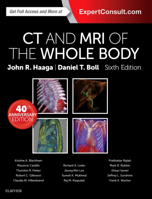 E-kniha Computed Tomography & Magnetic Resonance Imaging Of The Whole Body E-Book John R. Haaga