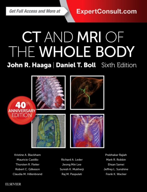 E-book Computed Tomography & Magnetic Resonance Imaging Of The Whole Body E-Book John R. Haaga