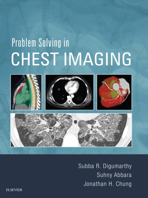E-book Problem Solving in Chest Imaging E-Book Subba R Digumarthy