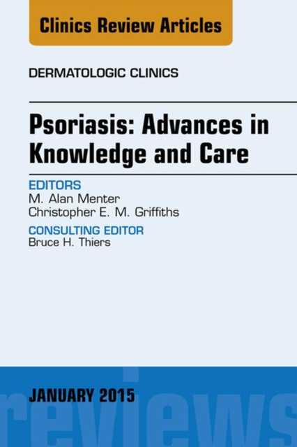 E-kniha Psoriasis: Advances in Knowledge and Care, An Issue of Dermatologic Clinics Alan Menter